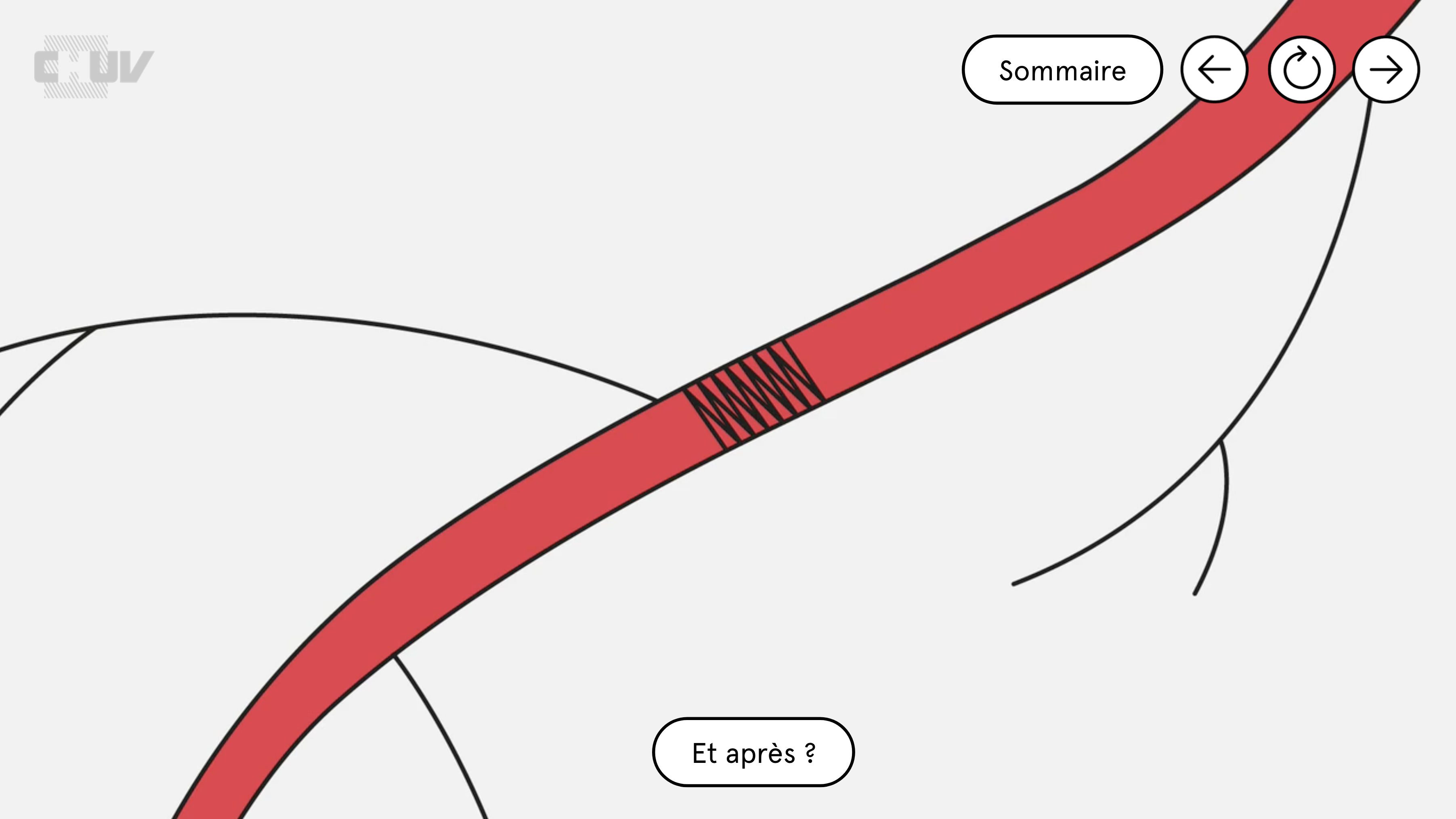 Illustration scientifique simplifié d'une veine avec un stent.